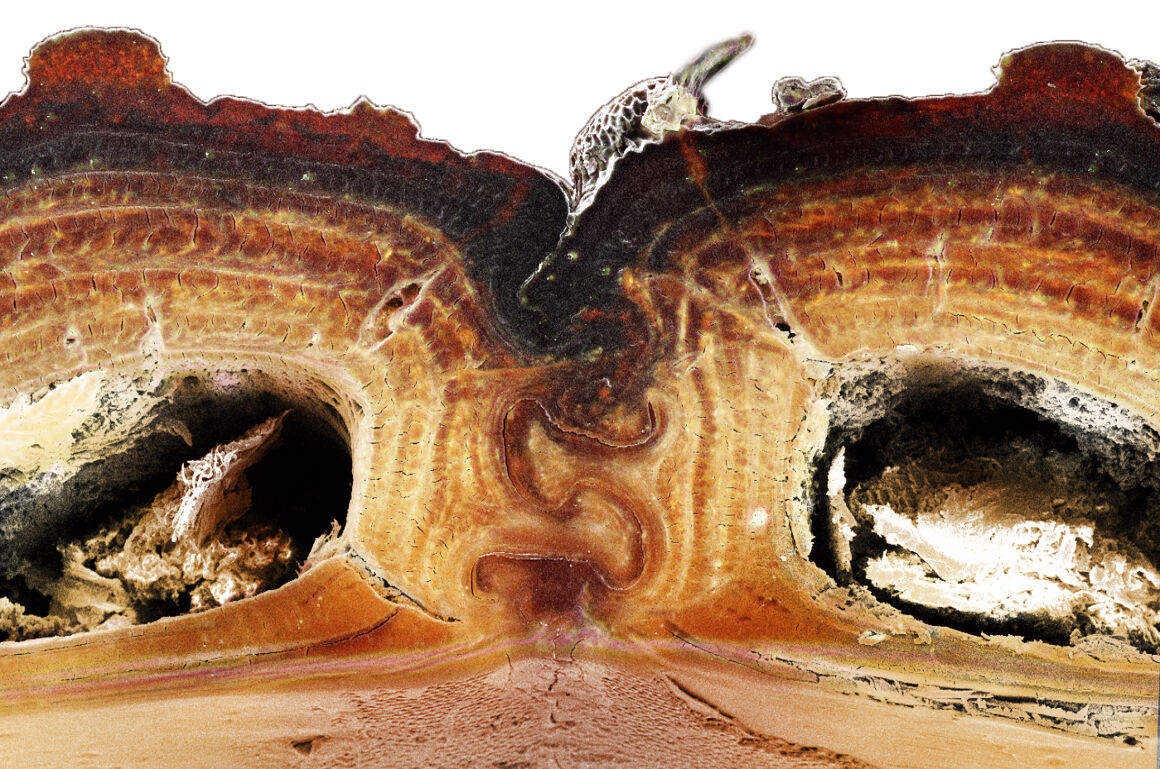 Beetle armor